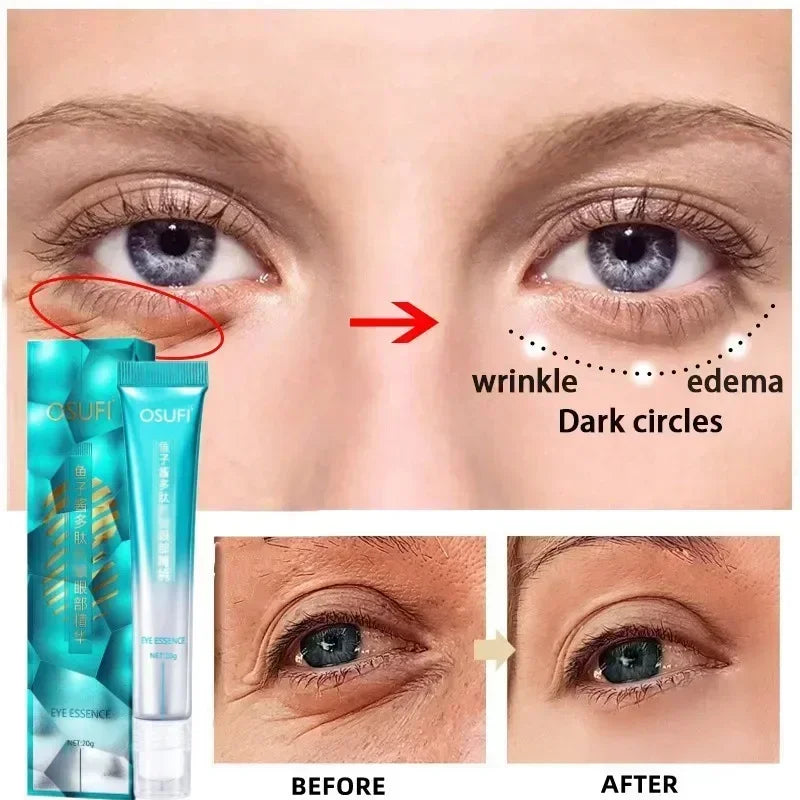 Anti Dark Circle Eye Cream Reduces Dark Circles Eye Remover Eye Bags Tightens Skin Moisturizes Skin Massages Essence Eye Care