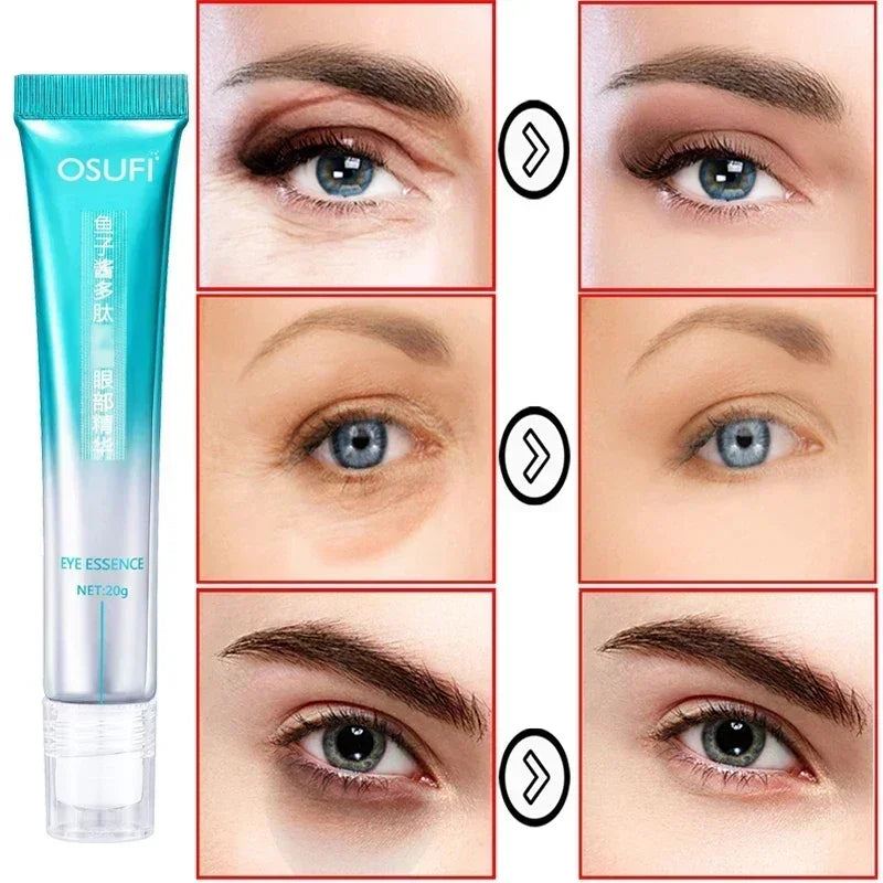 Anti Dark Circle Eye Cream Reduces Dark Circles Eye Remover Eye Bags Tightens Skin Moisturizes Skin Massages Essence Eye Care